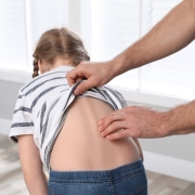 Skolyoz dereceleri, Cobb açısı