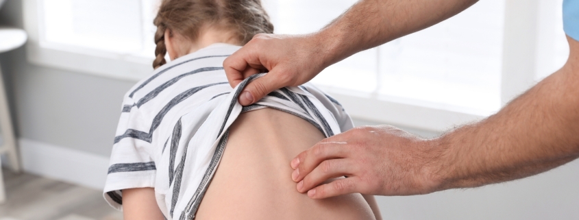 Skolyoz dereceleri, Cobb açısı